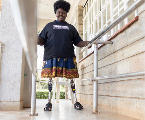 The Shoe That Grows on prosthetic limbs
